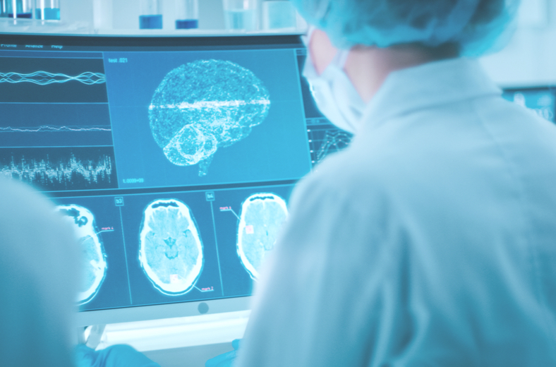 Healthcare professionals watching brain’s scan